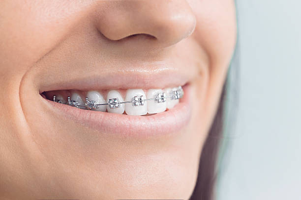 Best Wisdom Tooth Removal  in Saint John Fisher College, NY